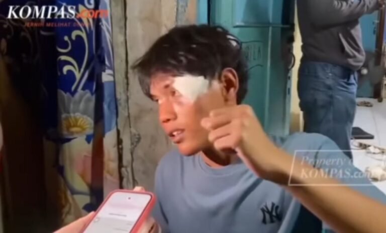 Pelajar ini juga Jadi Korban Pengeroyokan Sejumlah Orang Tak Dikenal Pascademo