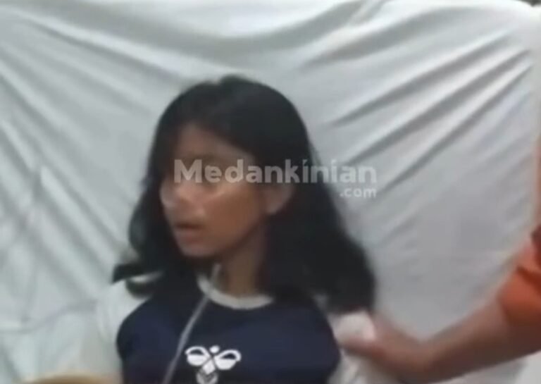 Siswi Berprestasi di Karo yang Keracunan MBG Alami Gangguan Ingatan hingga 70 Persen